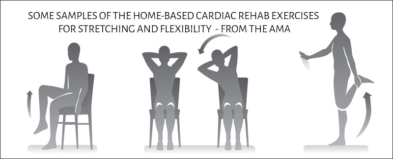 Cardiac Rehab Exercises Do Them (Safely) At Home