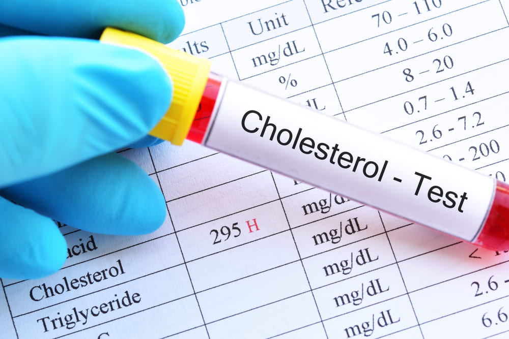 “What are the early warning signs of high cholesterol? I need to know this…”